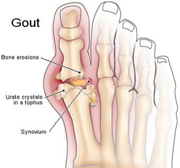 Gout-Cosmic Homeo haling Centre