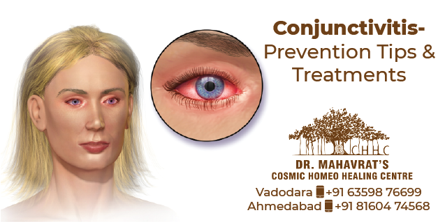 Conjunctivitis Prevention Tips and Treatments in CHHC